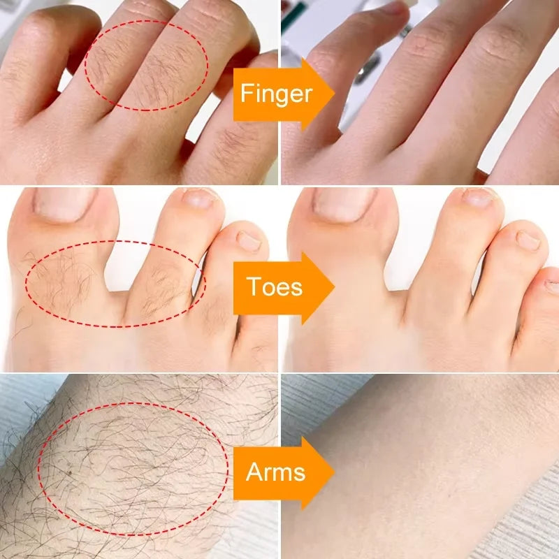 Fast Hair Removal Cream