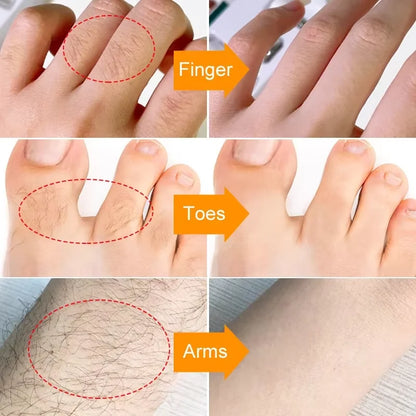 Fast Hair Removal Cream