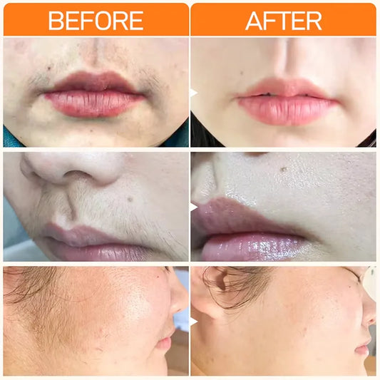 Fast Hair Removal Cream