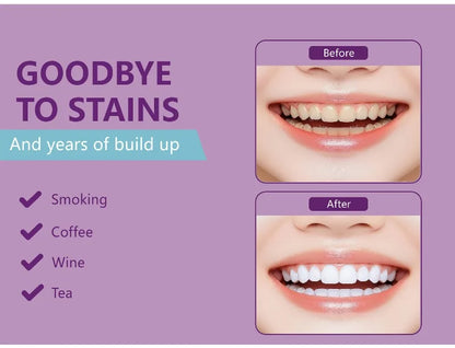 PAP+ Teeth Whitening Strips