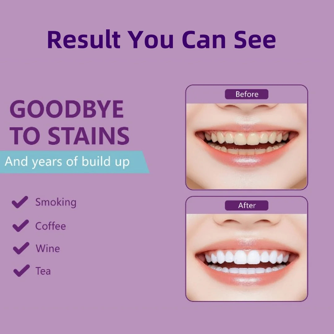 PAP+ Teeth Whitening Strips