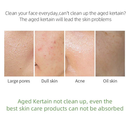 LAIKOU Matcha Exfoliating Peeling Gel