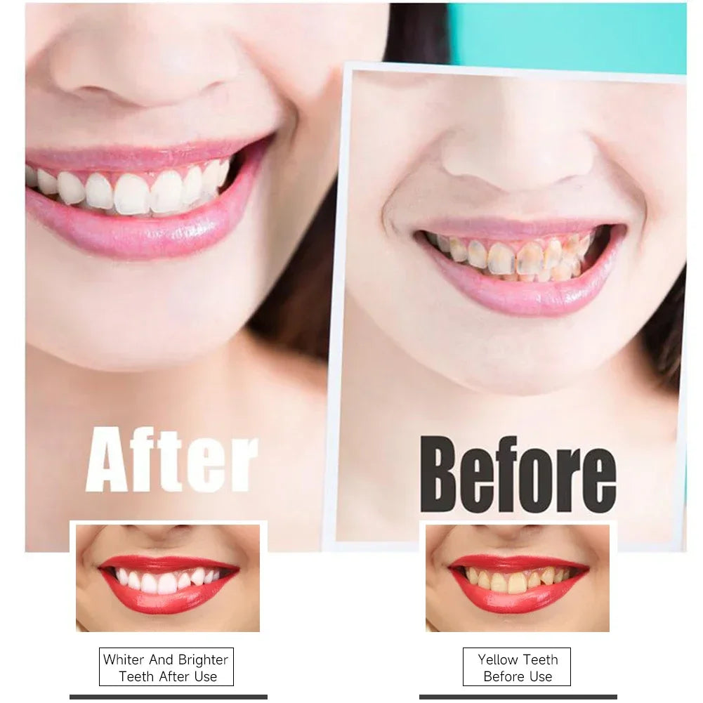 PAP+ Charcoal Teeth Whitening Strips