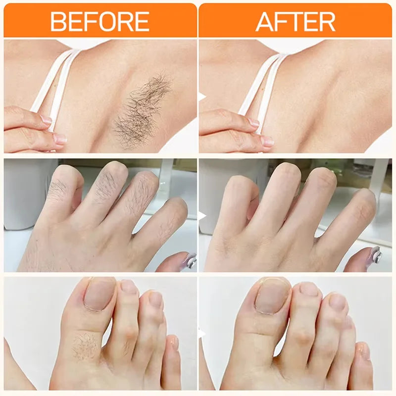 Fast Hair Removal Cream