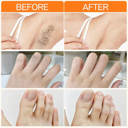 Fast Hair Removal Cream