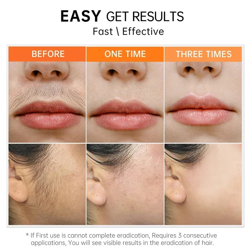 Fast Hair Removal Cream